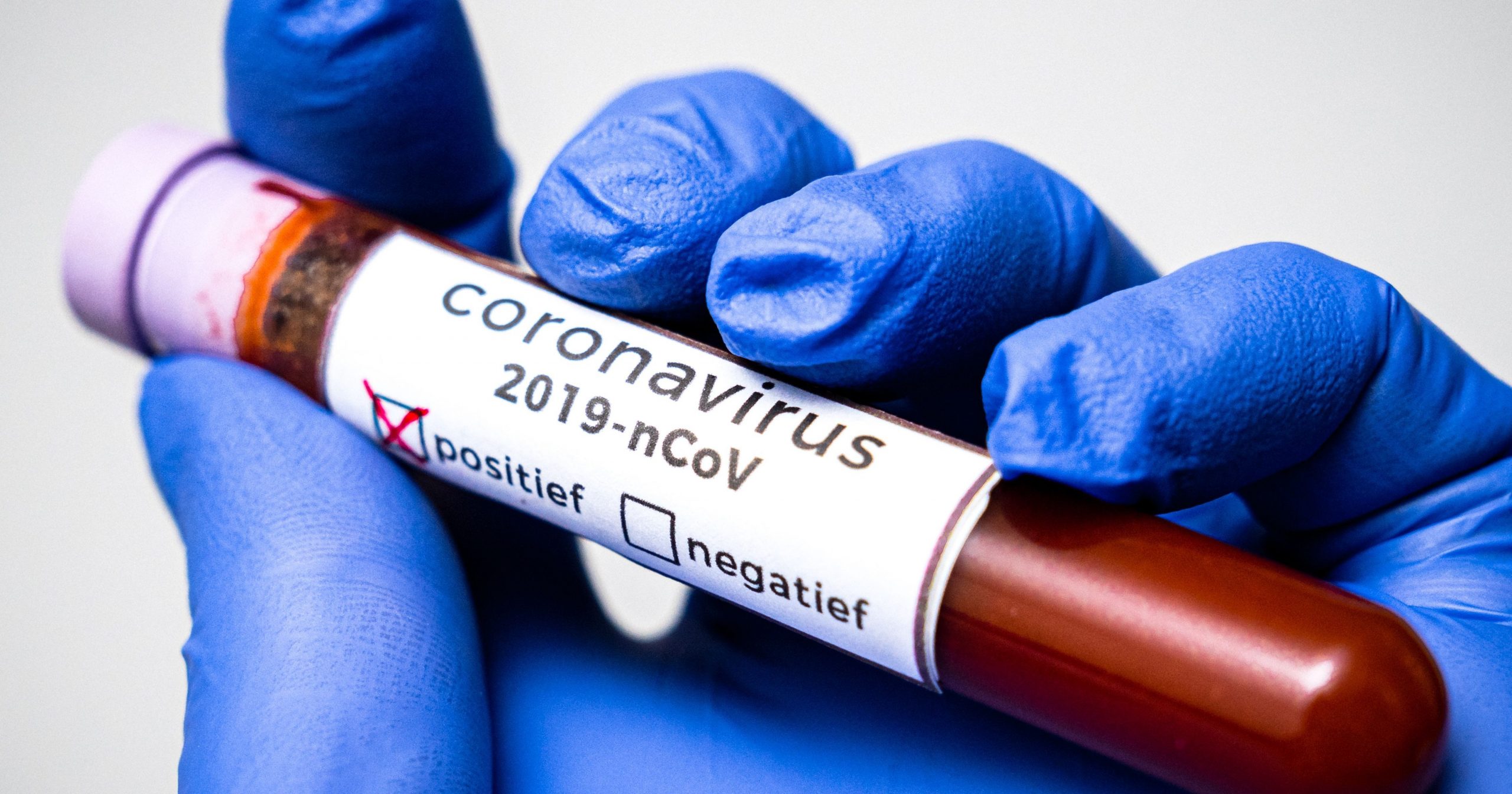 Как долго коронавирус остается на ручках дверей и унитазах?