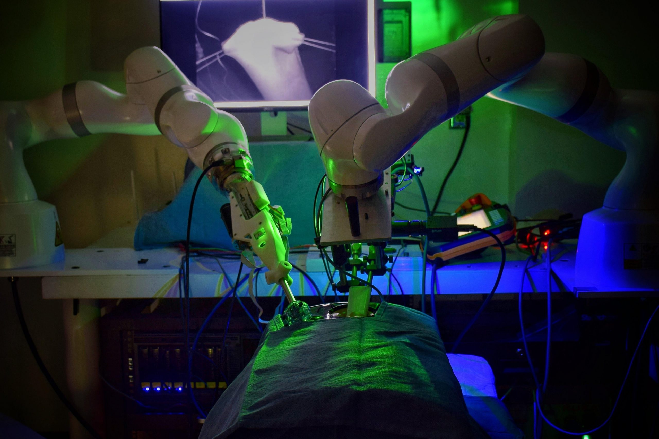 Робот-хирург впервые провел сложную операцию без вмешательства человека: инженерное чудо