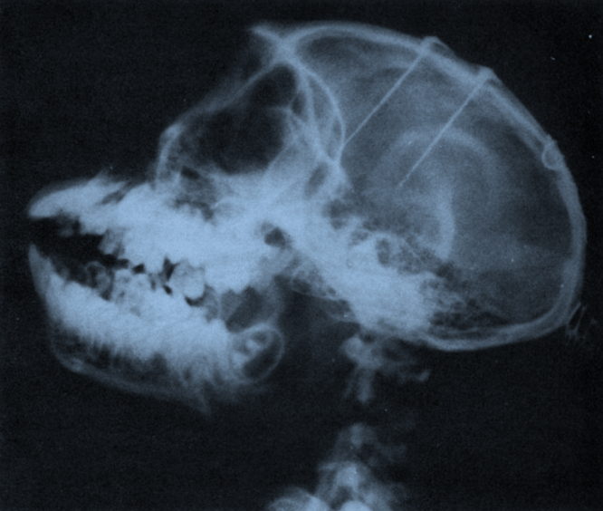 Рентгеновский снимок головы обезьяны с имплантированным устройством Дельгадо