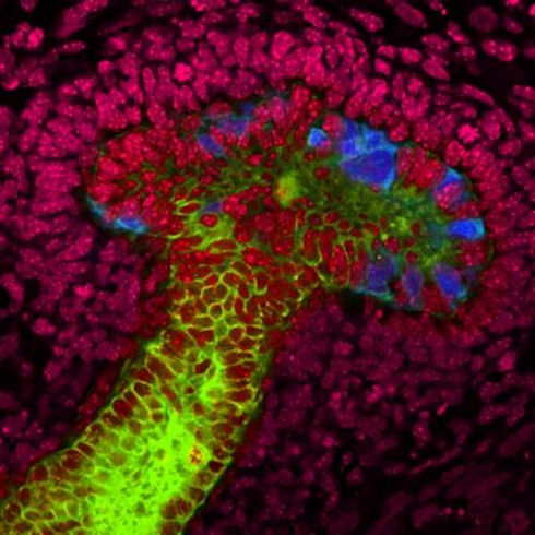 Ученые вырастили почки из стволовых клеток человека