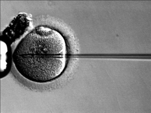 Мужские половые хромосомы не помешали женщине родить здоровых детей