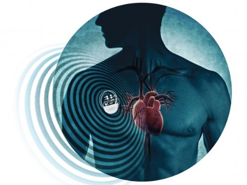 Хакеры научились убивать владельцев кардиостимуляторов